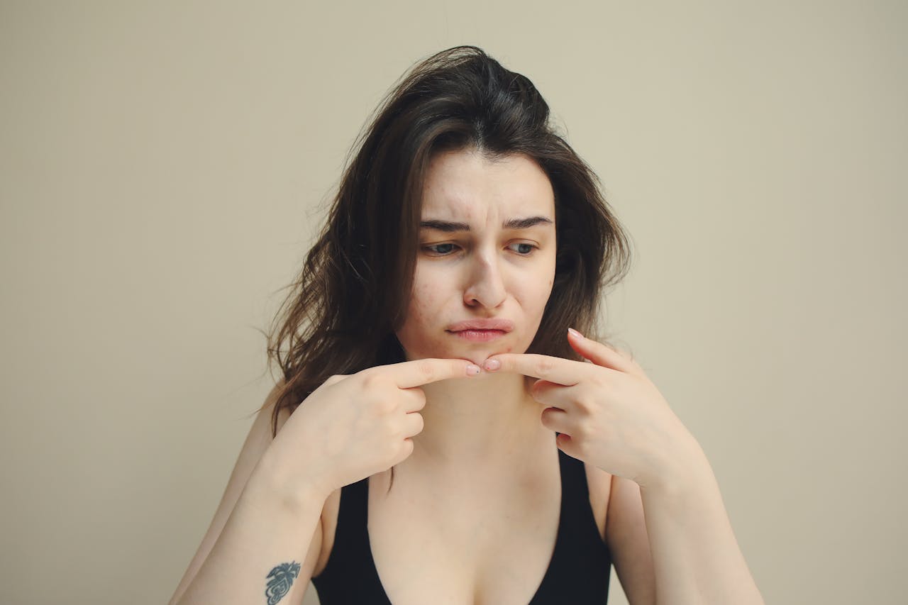 A woman looks at her skin with concern, touching her chin, worried about acne.